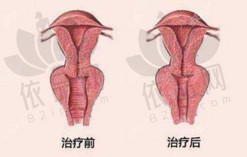 成都欧诺森医疗美容门诊部鼻中隔、膨体隆鼻及隆胸、双眼皮等项目价格全知晓