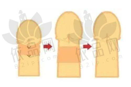 眼部整形项目类型