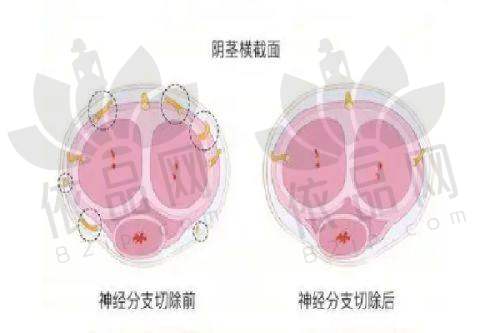 福州新世纪整形外科陈志明医生的预约方式