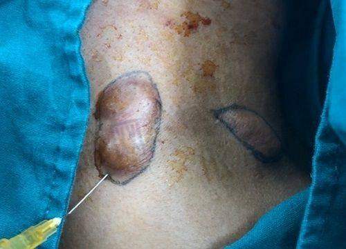 吴焱秋医生资质信息