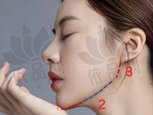 4、复旦大学附属华 山医院 - 整形外科