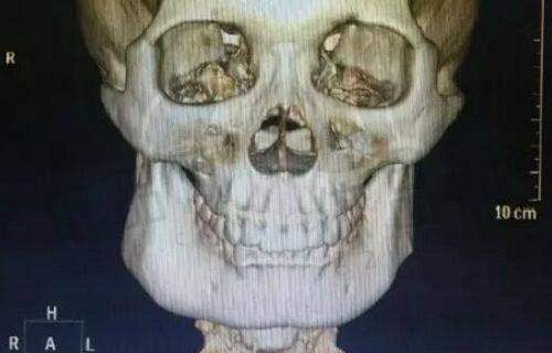 特色整形项目介绍