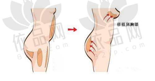 成都尼斯铂尚医疗美容门诊部眼部项目价格曝光,埋线3972元起,综合11729元起