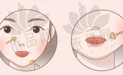 武汉赵月强医生做脂肪填充好吗?擅长多部位填充,案例效果佳价格合理