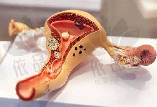 阴唇馒头型号还是蝴蝶型的好看?健康优势各有不同