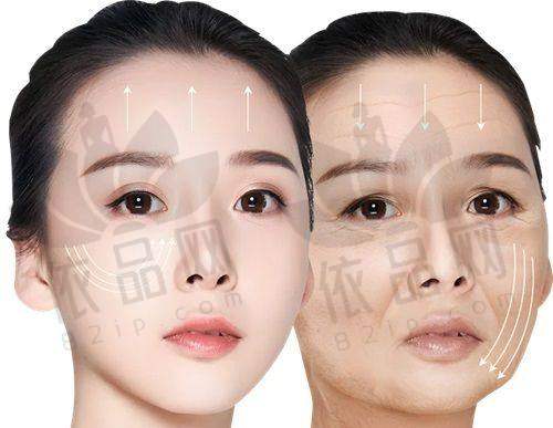 上海做中下面部拉皮的医生推荐倪锋,19年拉皮经验技术强,手术效果优费用合理