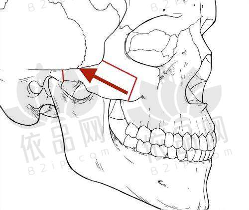 福州新世纪整形外科陈志明医生的口碑评价