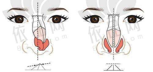 内江韩美医疗美容门诊部多项医美项目价格大公开,隆鼻、脱毛费用一目了然