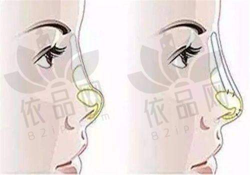 李石——技术优势