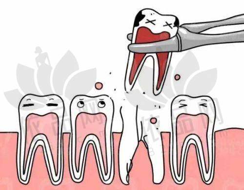 福州正嵘口腔曾文涛医生擅长项目