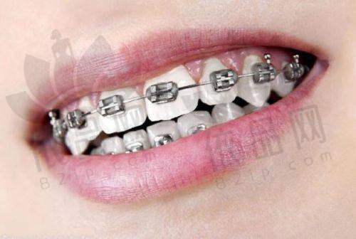 一、仙桃市第一人民医院口腔科收费标准详情