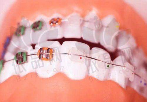 林杰医生预约方式