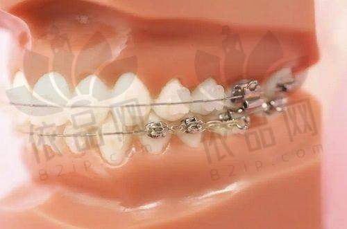 强大的技术团队与精良理念