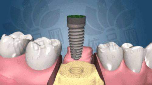 七、选择福州正嵘口腔的理由