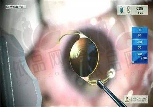 河北医 科 大学第二医院眼科预约挂号注意事项