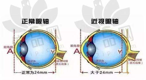 江门眼科手术收费标准