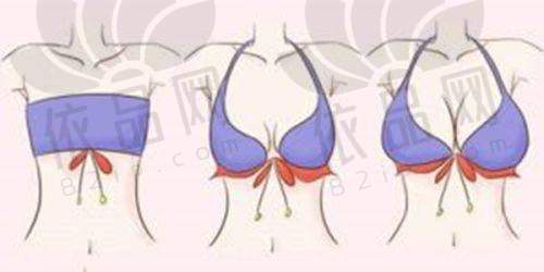 鼻部整形项目及价格