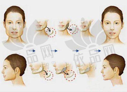 6、北京煤医医疗美容医院