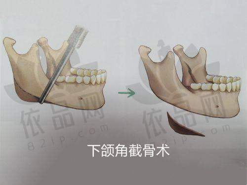 厦门伊美整形美容门诊部2025年价格表参考