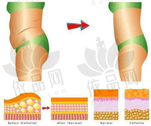 李春财:预约方式
