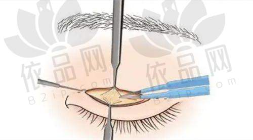 陈翠云 医生预约方式