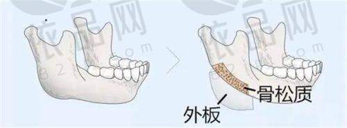 北京米兰柏羽丽都于晓春医生特色技术优势