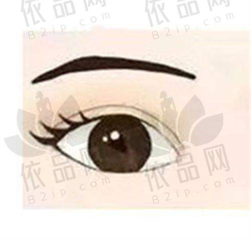 成都杨迪医生眼周筋膜提升效果佳,改善多问题,维持3年+价格优