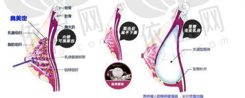 成都蓉美和谐医疗美容门诊部2025年价格表