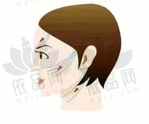 谭永嘉医生坐诊重庆联合丽格五院,可预约微拉美面部提升术