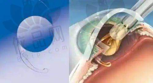 成都莱雅医疗美容诊所2025年价格表