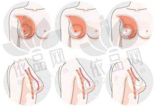 正版玻尿酸的特性