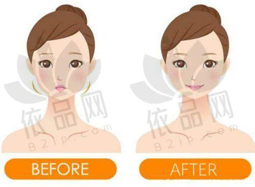 厦门思明美仑美奂医疗美容医院收费价格表