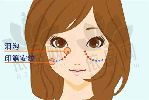 冯牧夷吸脂项目