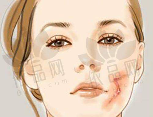 洪春医生口碑评价