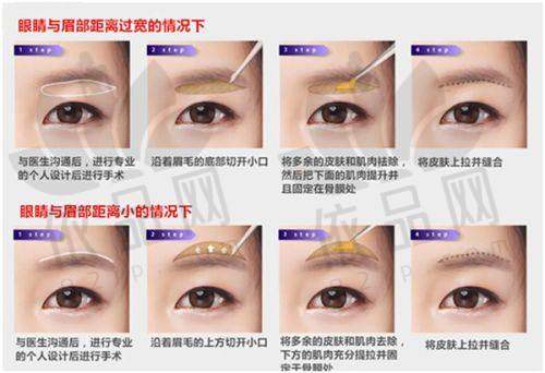 华美疤痕修复中 心核心优势