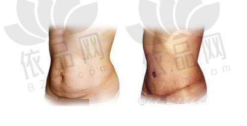 北京米兰柏羽丽都曹令医生技术特色优势