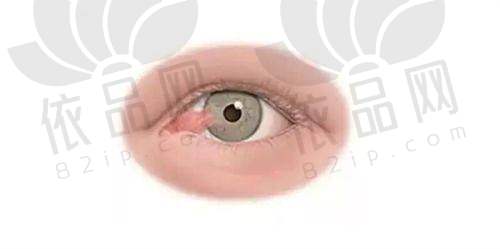 河北医 科 大学第二医院眼科现场预约挂号攻略