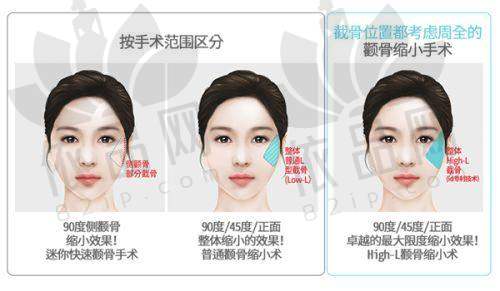 2、上海交通大学医学校附属第九人民医院 - 整复外科