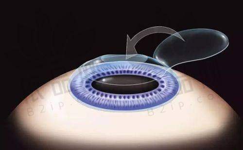 林青鸿医生的特色技术优势