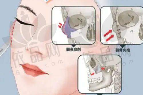 北京英煌医疗美容王勋医生:口碑评价