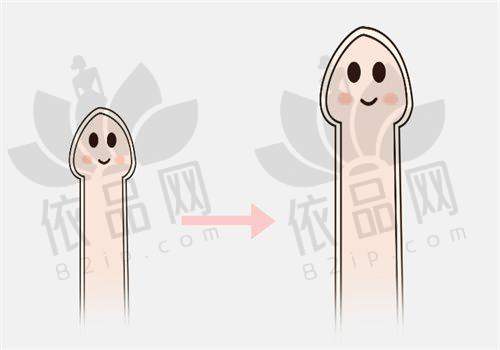 李世荣医生做男科整形手术怎么样?技术精湛功效好修复快,正规靠谱无套路值得选