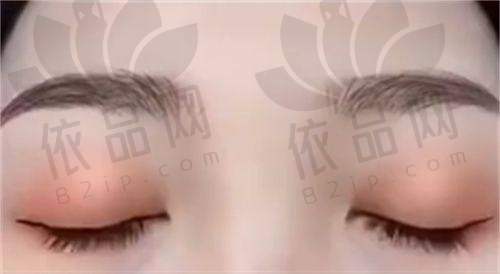 面部整形的精细雕琢