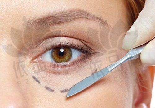 武汉王海平和谭琳谁修复双眼皮更好?王海平擅解复杂问题,谭琳重整体美观缝合精细