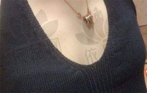 北京英煌医疗美容王勋医生:擅长项目