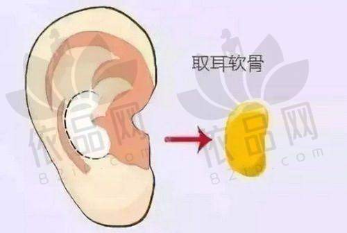 2、昆明艺星丰胸价格