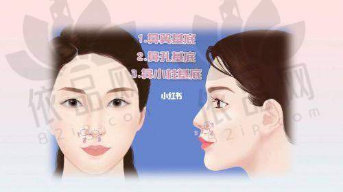 杨青青医生特色技术优势