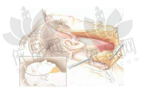 程序员小哥腰腹环吸:健康与美丽双丰收