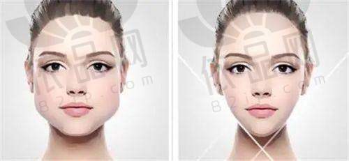 北京英煌医疗美容王勋医生:技术优势与特色