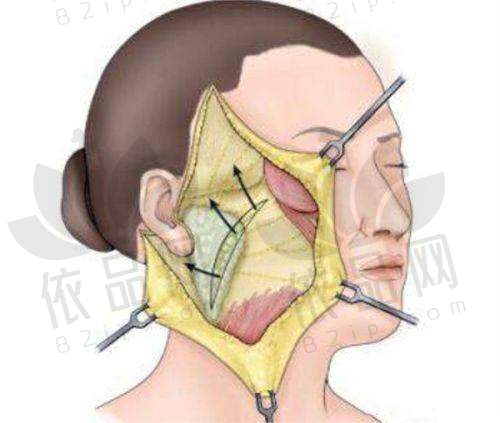 鼻部整形的专精造诣