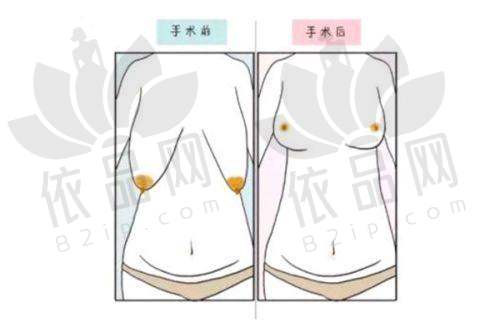 杨青青医生口碑评价